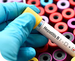 Mi a különbség az egyes hepatitisztípusok közt?